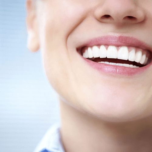 professional teeth whitening