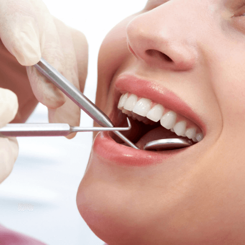 Root canal retreatment