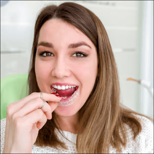 all about invisalign